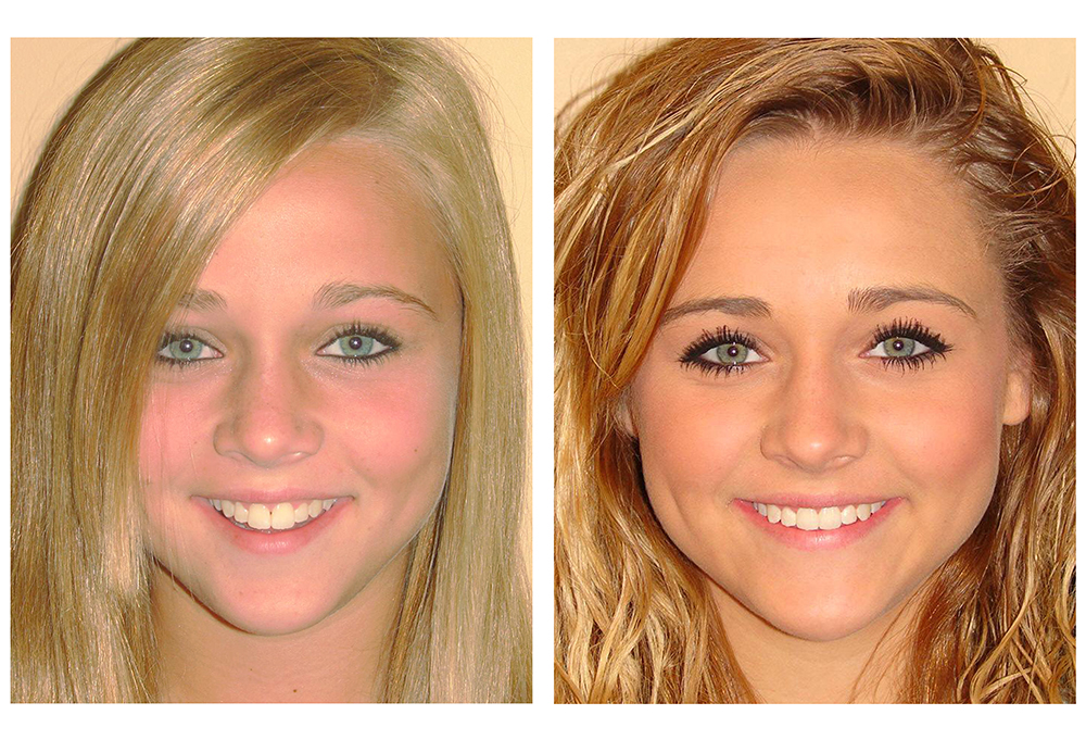 Dynamic Dental   Orthodontics